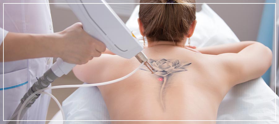 The 10 best tattoo removal specialists in Visakhapatnam - Last Updated  February 2024 - StarOfService